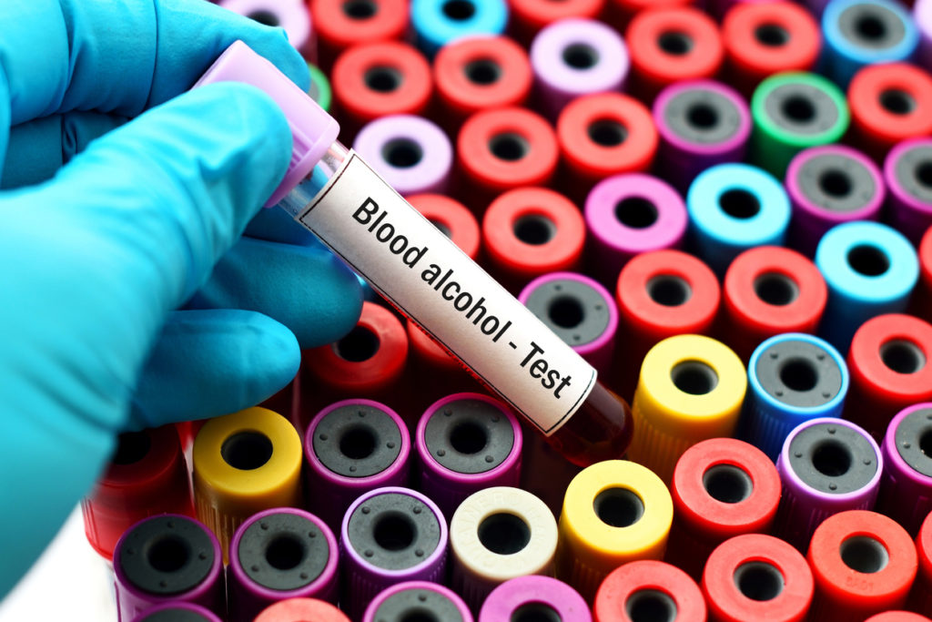 blood alcohol test sample